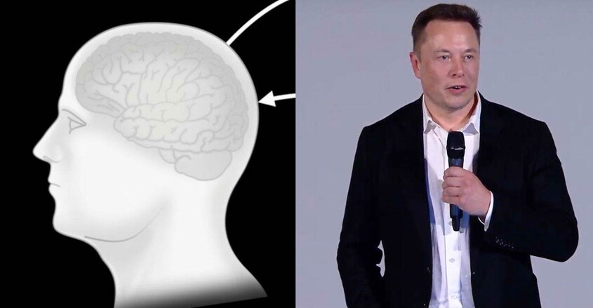 neuralink-presentation-elon-musk neuralink-presentation-elon-musk