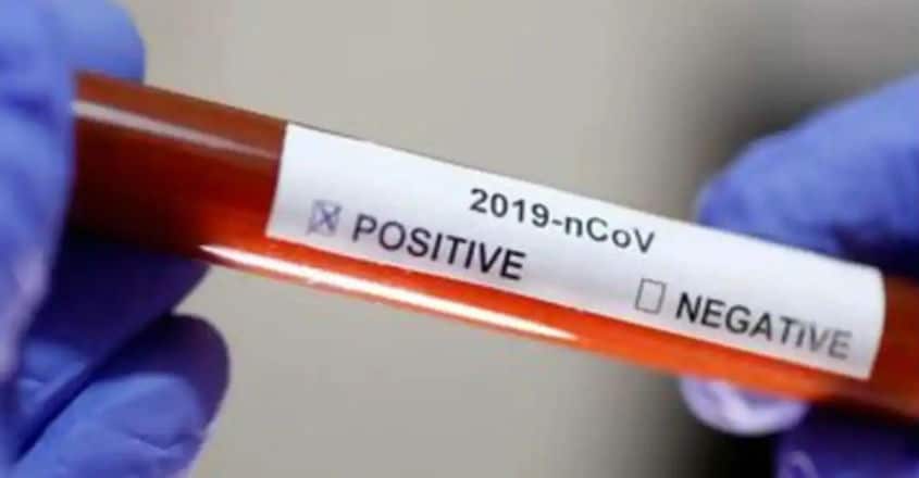 Coronavirus-positive-test Coronavirus-positive-test