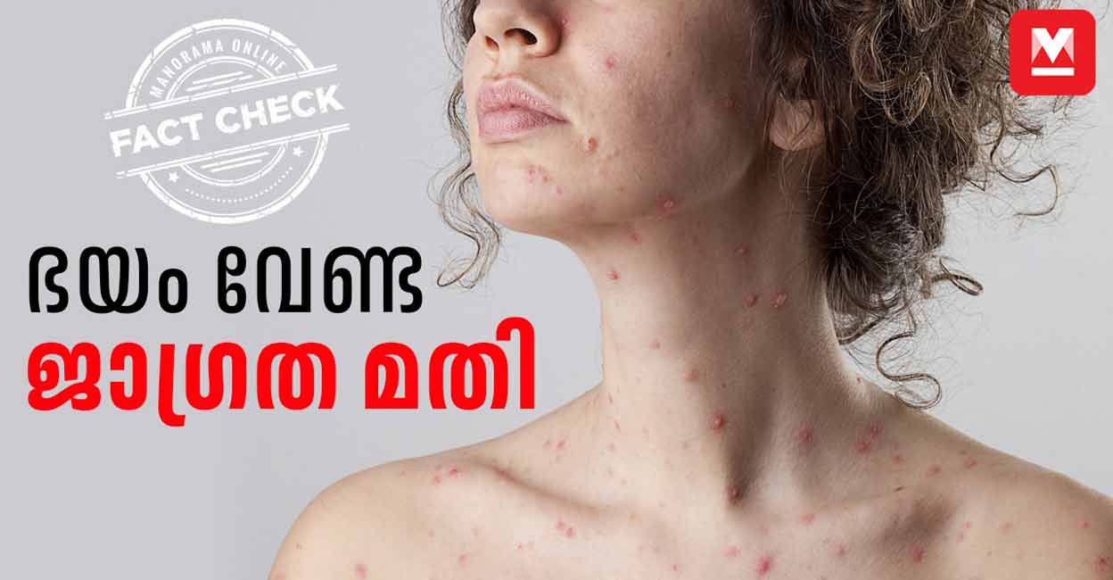 ഭയം വേണ്ട ജാഗ്രത മതി | Chickenpox | FactCheck